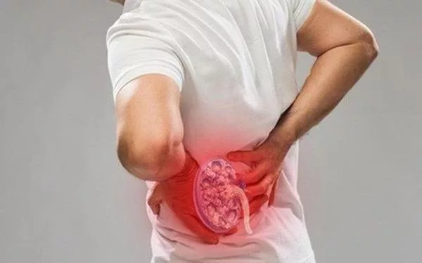 Do not underestimate urinary stones